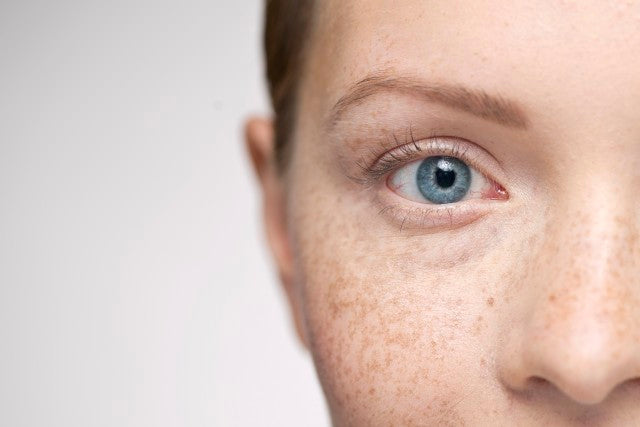 close up of face with freckles and blue eyes