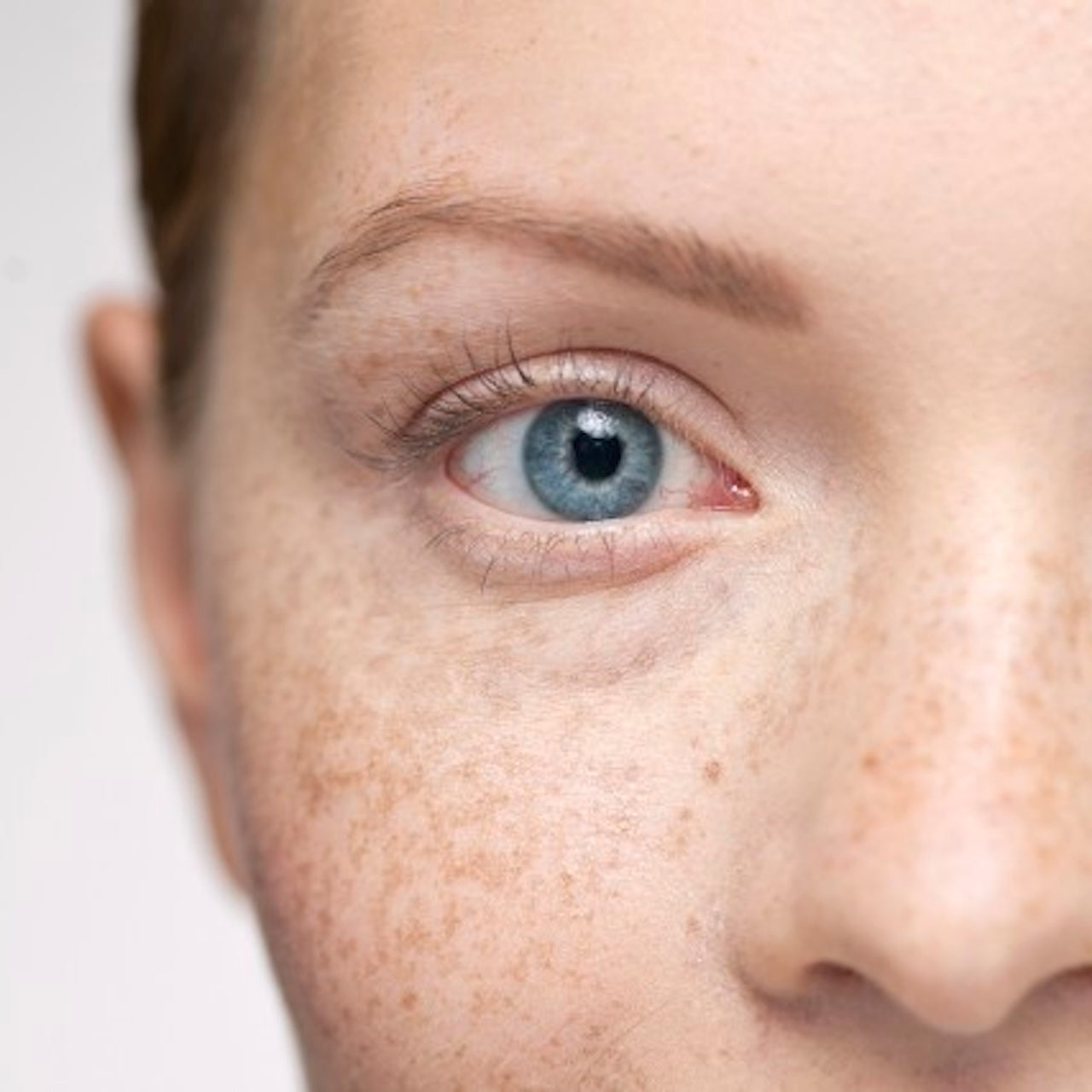 close-up-of-eye-boost-treatment