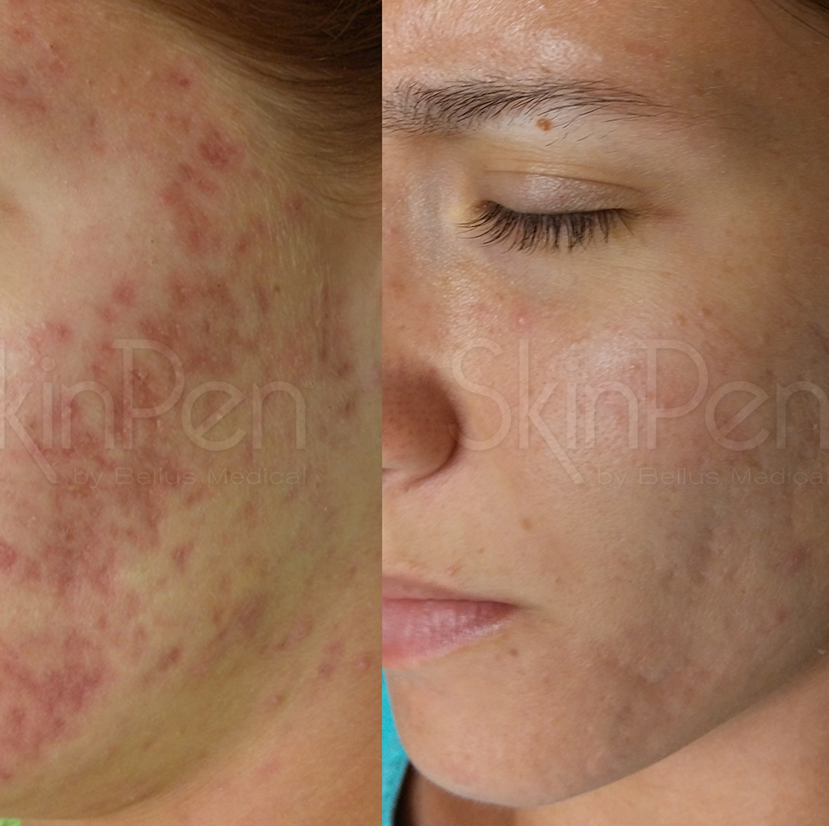 anti-pigmentation-close-up-female-face