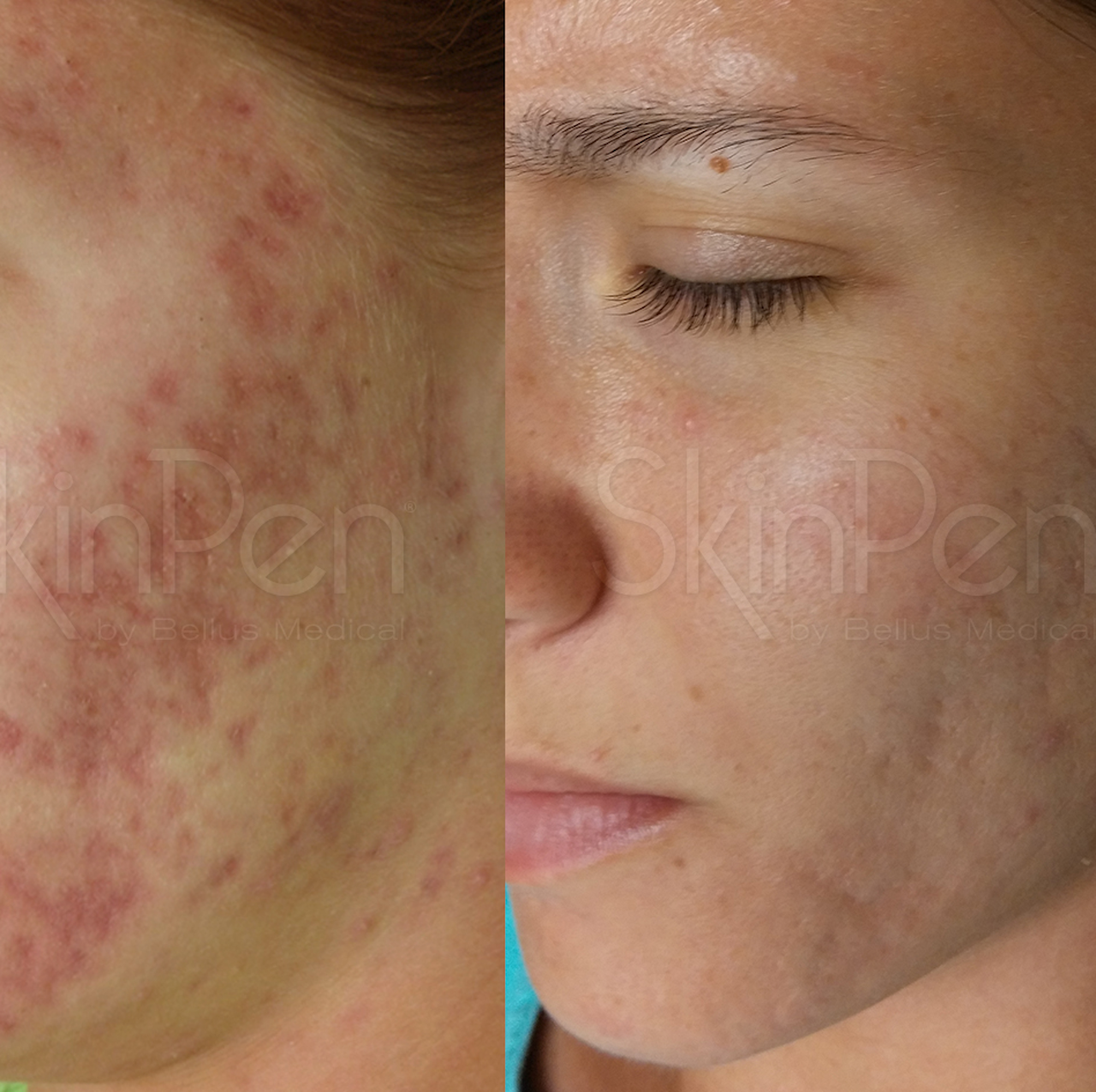 anti-pigmentation-close-up-female-face