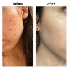 Skinade Targeted Solutions® Clear